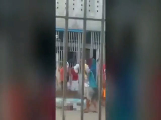 Lột da mặt ở brazil, phương pháp làm đẹp và những điều cần biết