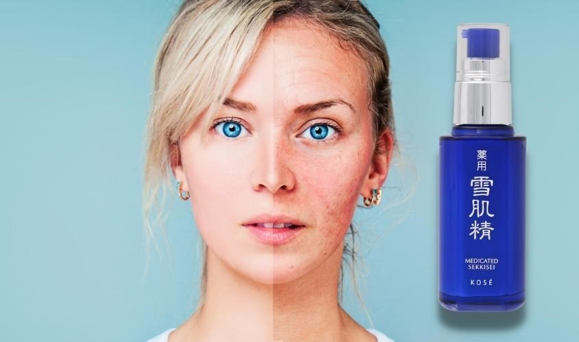 Serum dưỡng trắng da của nhật: lựa chọn tốt nhất cho làn da sáng mịn, khỏe mạnh