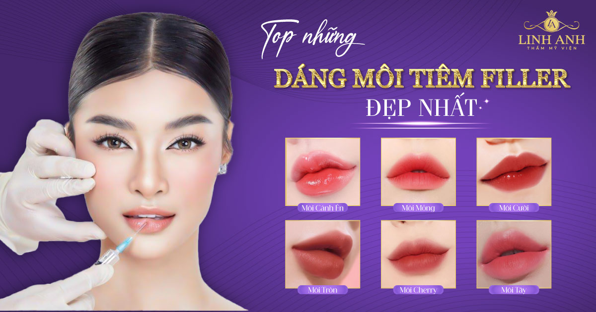 Tiêm filler Đẹp da: tìm hiểu chi tiết về phương pháp thẩm mỹ hiện Đại